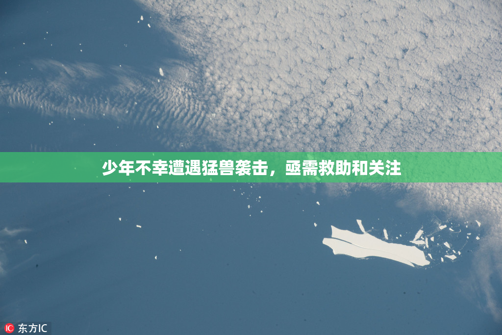 少年不幸遭遇猛兽袭击，亟需救助和关注