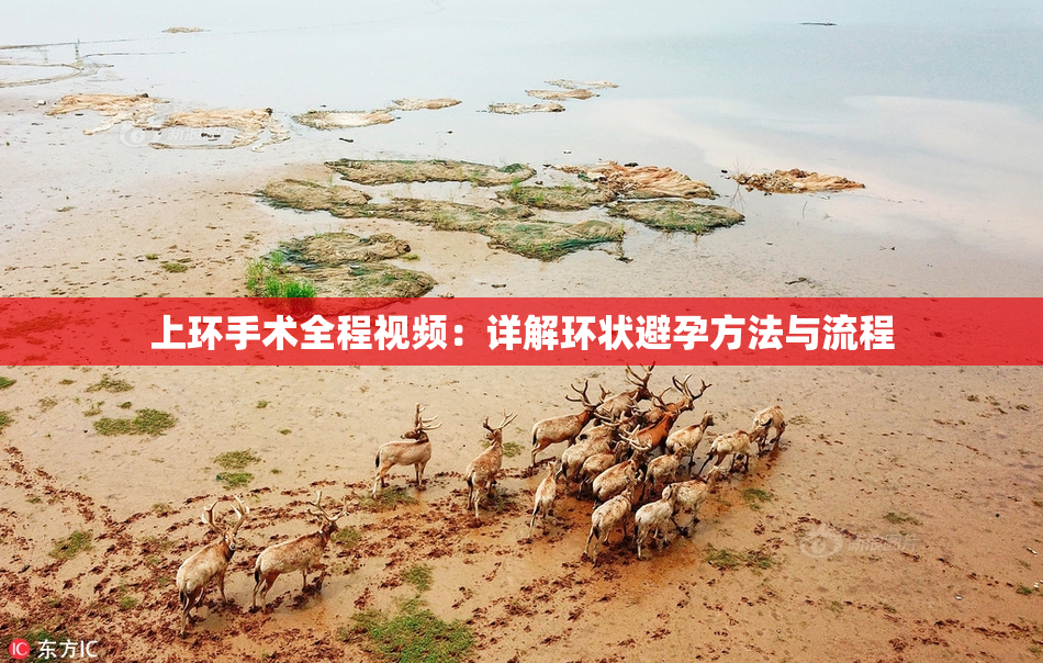上环手术全程视频：详解环状避孕方法与流程