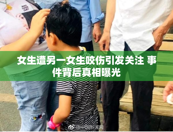 女生遭另一女生咬伤引发关注 事件背后真相曝光