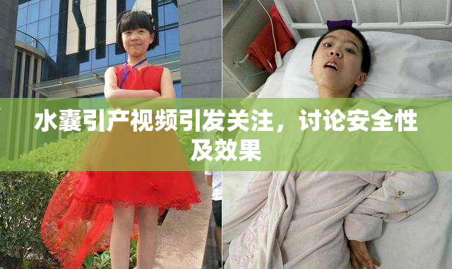 水囊引产视频引发关注，讨论安全性及效果