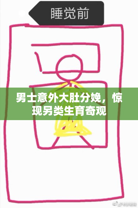 男士意外大肚分娩，惊现另类生育奇观
