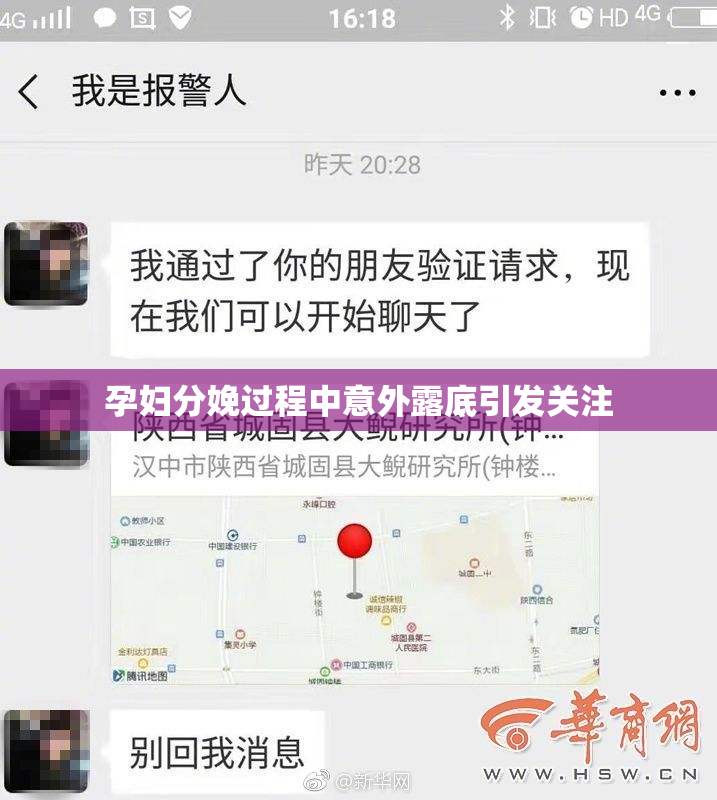 孕妇分娩过程中意外露底引发关注