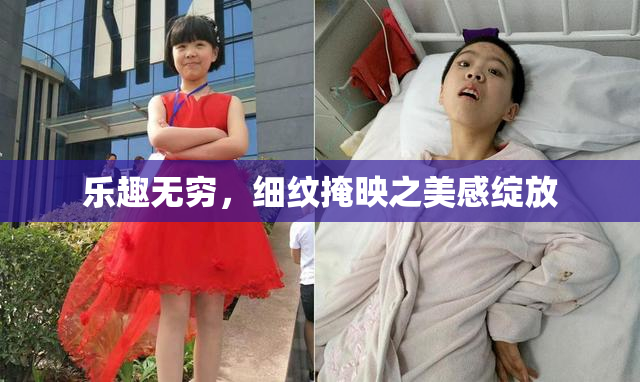 乐趣无穷，细纹掩映之美感绽放