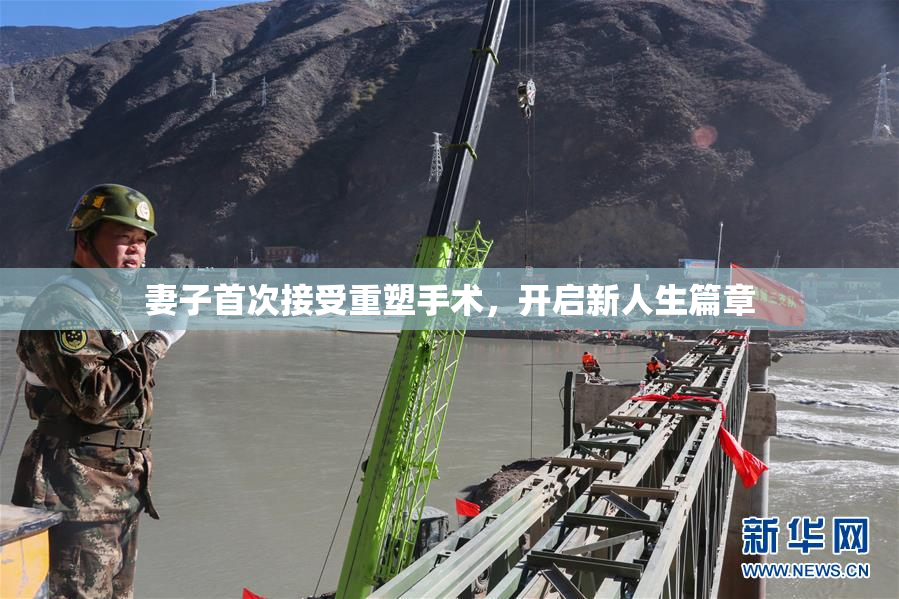 妻子首次接受重塑手术，开启新人生篇章