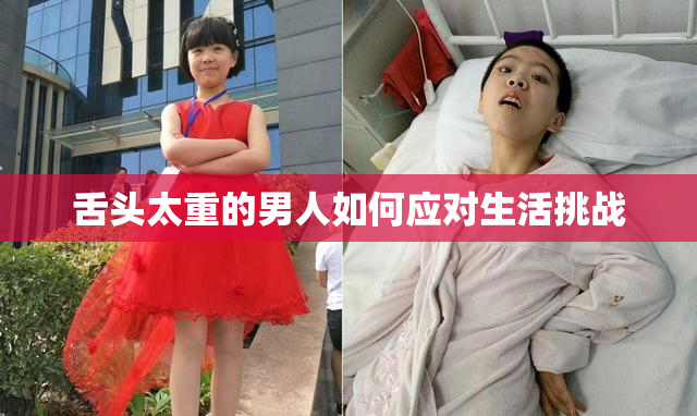 舌头太重的男人如何应对生活挑战
