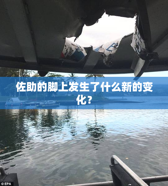 佐助的脚上发生了什么新的变化？