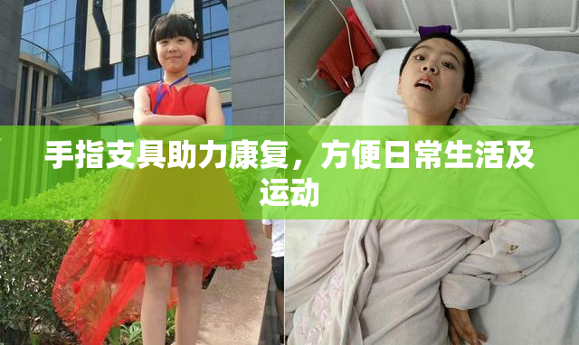 手指支具助力康复，方便日常生活及运动