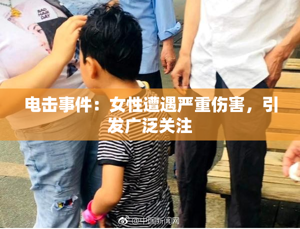 电击事件：女性遭遇严重伤害，引发广泛关注