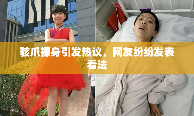 骇爪裸身引发热议，网友纷纷发表看法