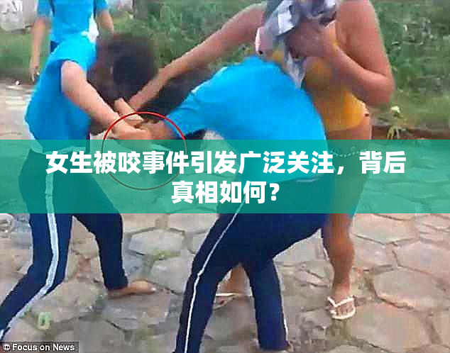 女生被咬事件引发广泛关注，背后真相如何？