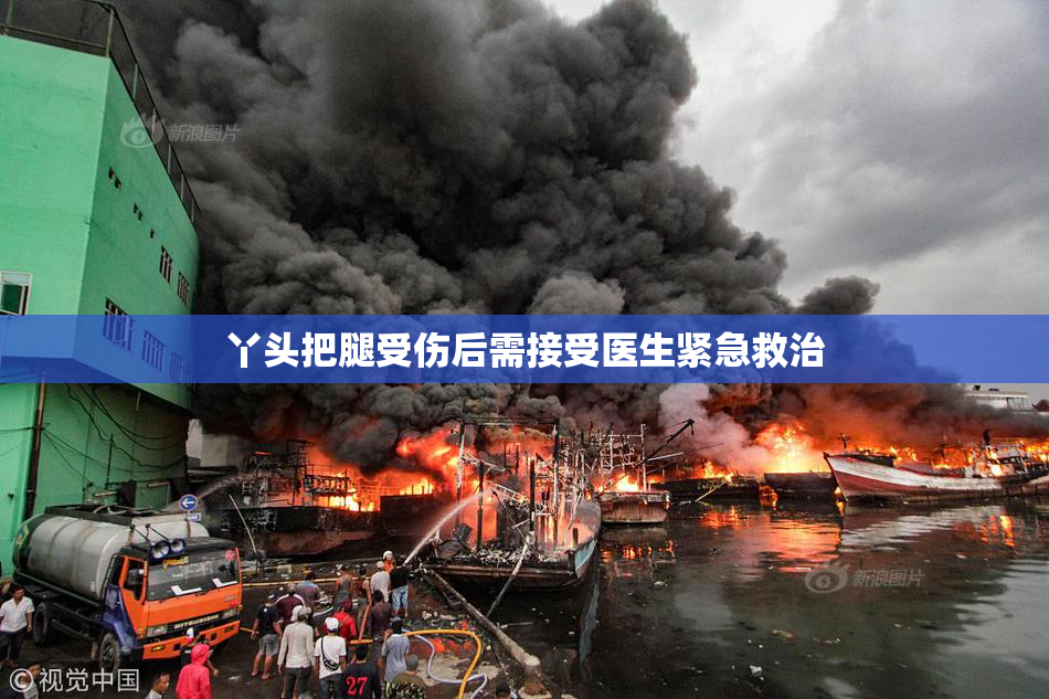 丫头把腿受伤后需接受医生紧急救治