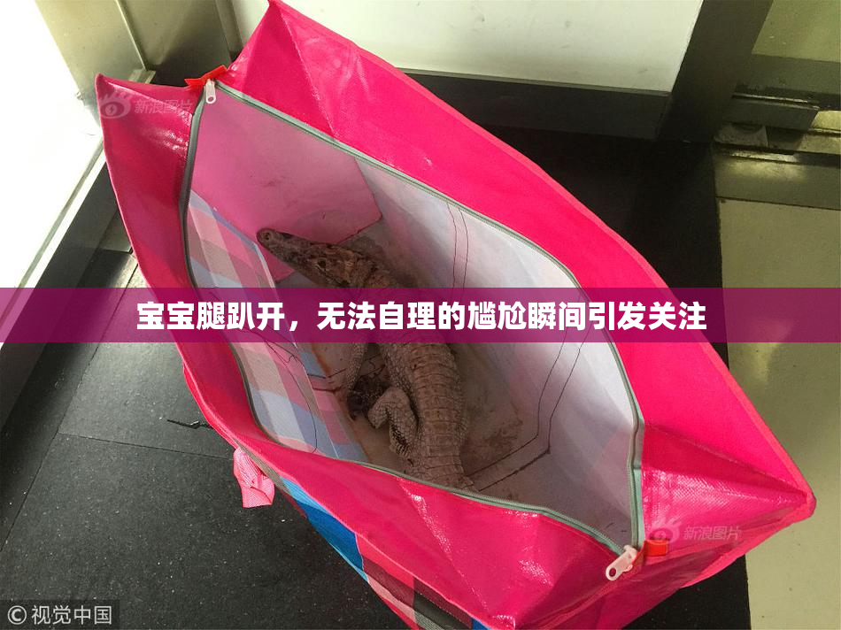 宝宝腿趴开，无法自理的尴尬瞬间引发关注