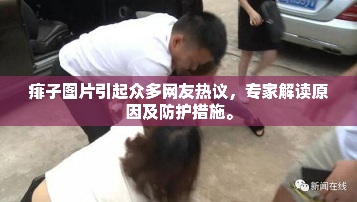 痱子图片引起众多网友热议，专家解读原因及防护措施。