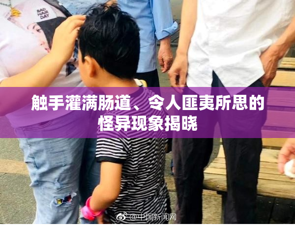 触手灌满肠道、令人匪夷所思的怪异现象揭晓